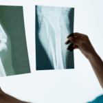 Dra. Thaline Neves revela como a radiologia é essencial para acompanhar e potencializar a reabilitação ortopédica.