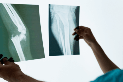 Dra. Thaline Neves revela como a radiologia é essencial para acompanhar e potencializar a reabilitação ortopédica.